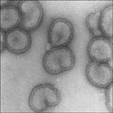 Photo of Influenza-A virus