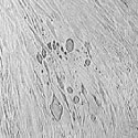Photo of Rhinovirus as seen through a microscope.